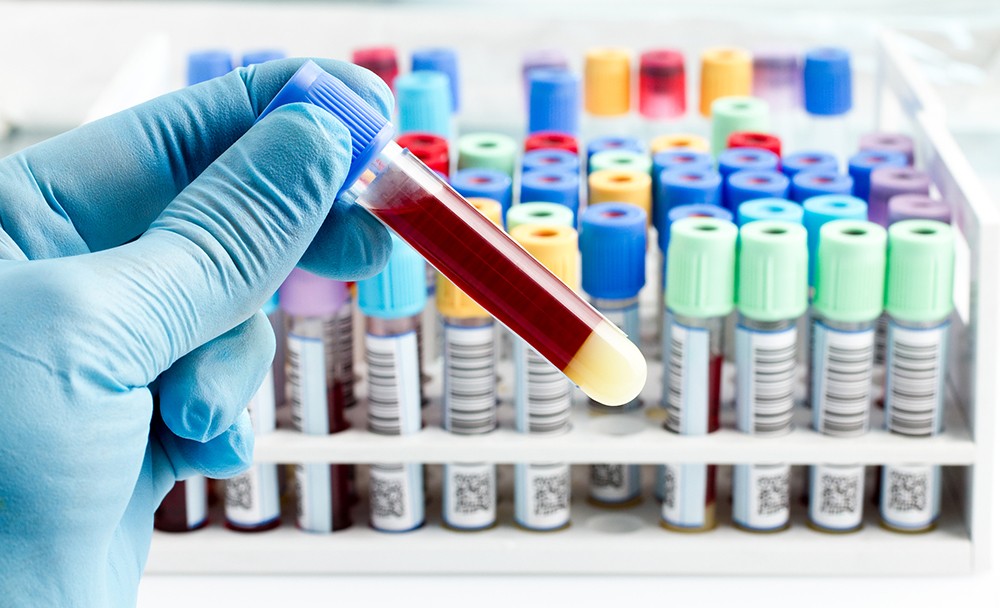 Vitamine: Definition, Aufgabe, Überversorung, Vitaminmangel